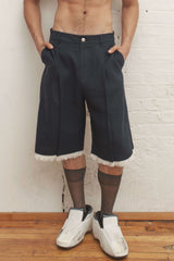Gabe Gordon Auto Shorts | distal phalanx