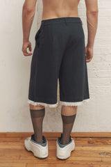 Gabe Gordon Auto Shorts | distal phalanx