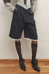 Gabe Gordon Auto Shorts | distal phalanx