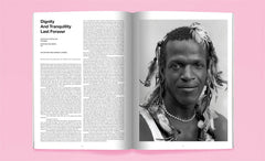 CANDY CANDY TRANSVERSAL 12 - distal phalanx